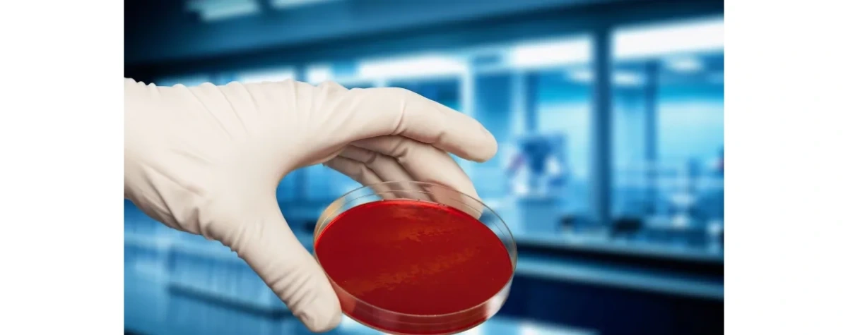 Gdańsk/ Polscy naukowcy opracowali metodę usuwania drobnoustrojów przy użyciu zimnej plazmy