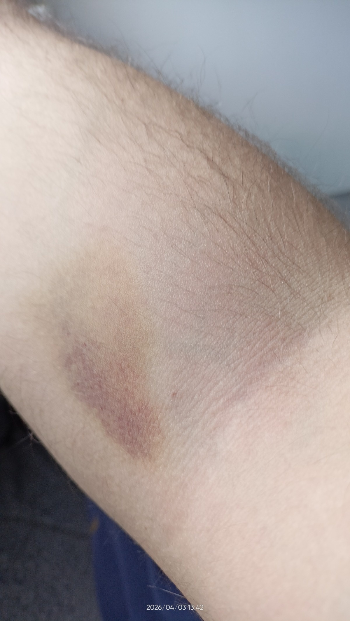 274b36b4-6368-43a1-8945-d6c88bc1fbfc