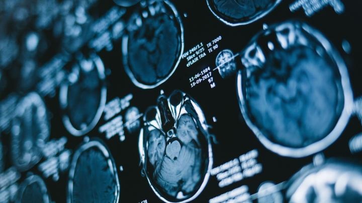 Ekspert: w CZD u 33 małych pacjentów przeprowadzono operacje mózgu bez otwierania czaszki