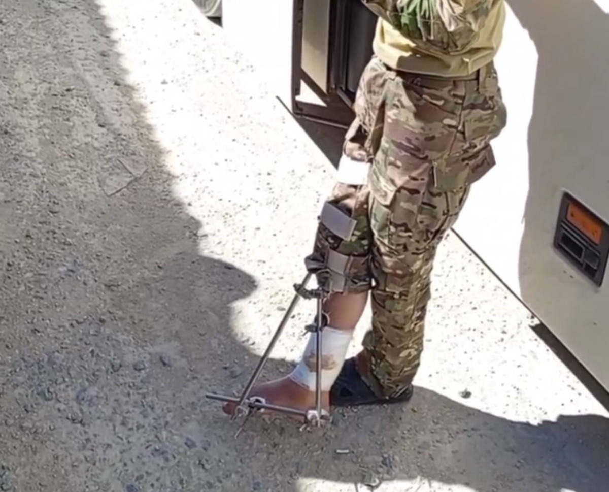 O rosyjskiej patologii z posyłaniem rannych ponownie na front