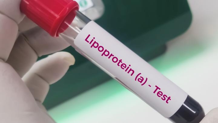 Polacy sprawdzili, czy niski poziom lipoproteiny zwiększa ryzyko cukrzycy