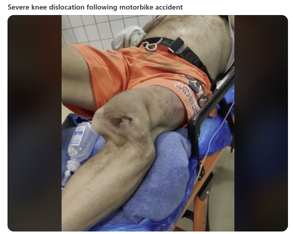 0c375160-4b48-46e5-a6fd-0f329aa02abe