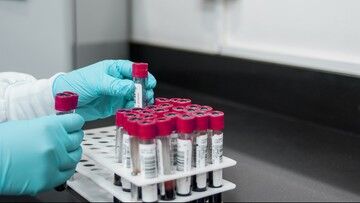 Koronawirus. WHO domaga się kontroli w chińskich laboratoriach
