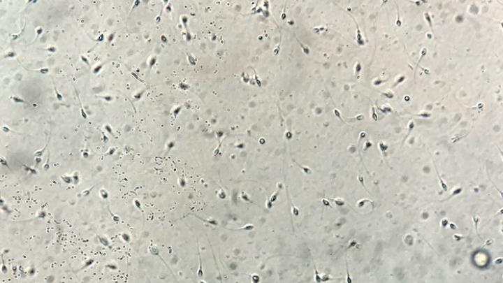 Przegrzewanie jąder uszkadza plemniki poprzez stres oksydacyjny - potwierdzają polskie badania