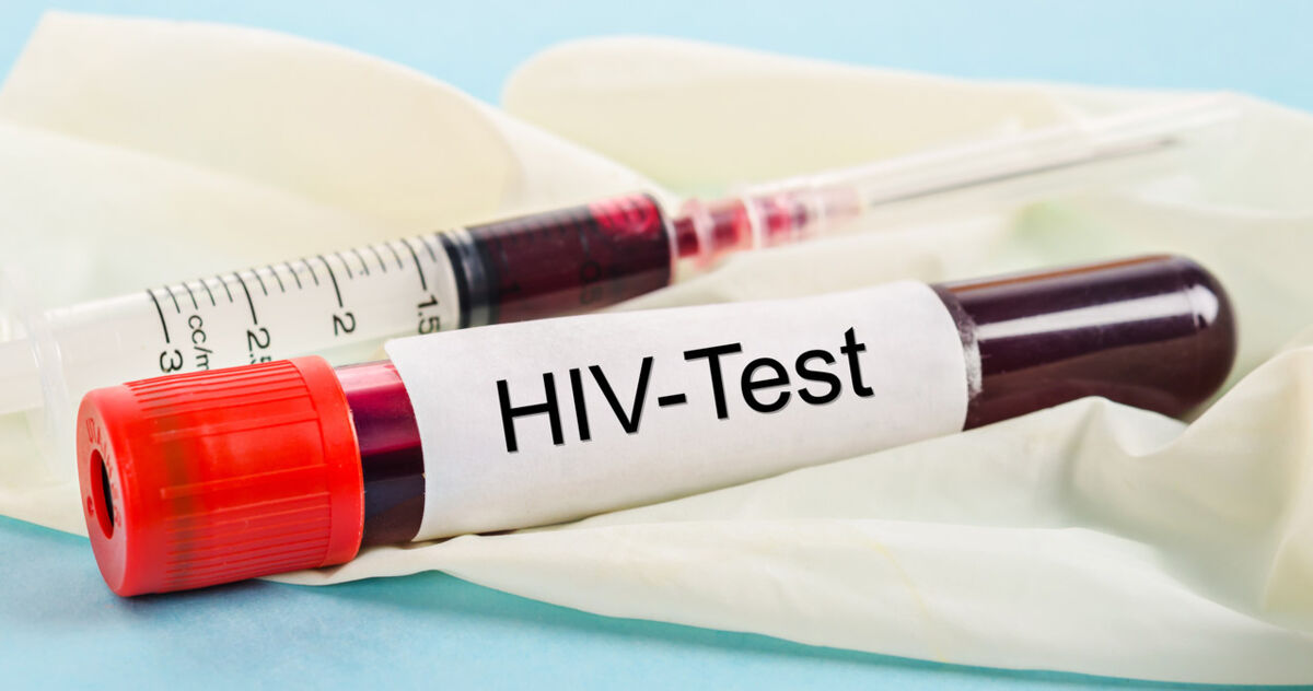 Trzeci przypadek wyleczenia z zakażenia HIV. Pomogła krew pępowinowa