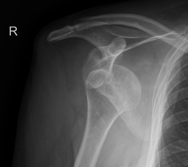 7f6f810f-1b1f-40d5-aae6-93f361e1cc0a