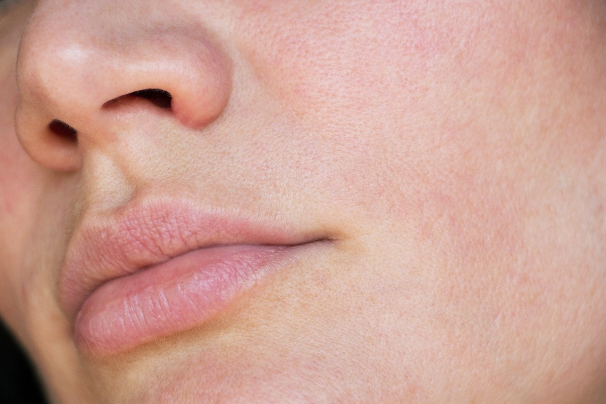 Dlaczego Twoja skóra "pije" kremy i wciąż jest ściągnięta? Bo jest odwodniona!