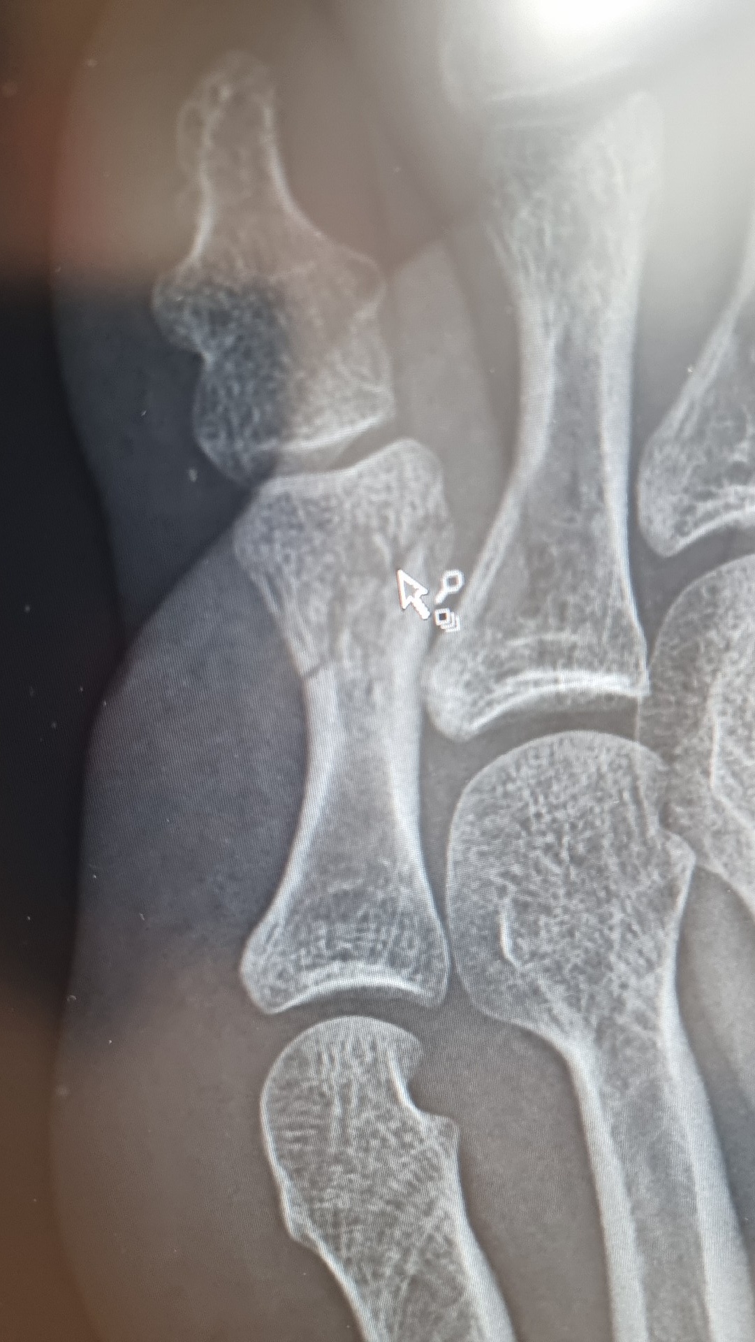 f6a56ac4-0c84-4574-801f-f1d8c316f741