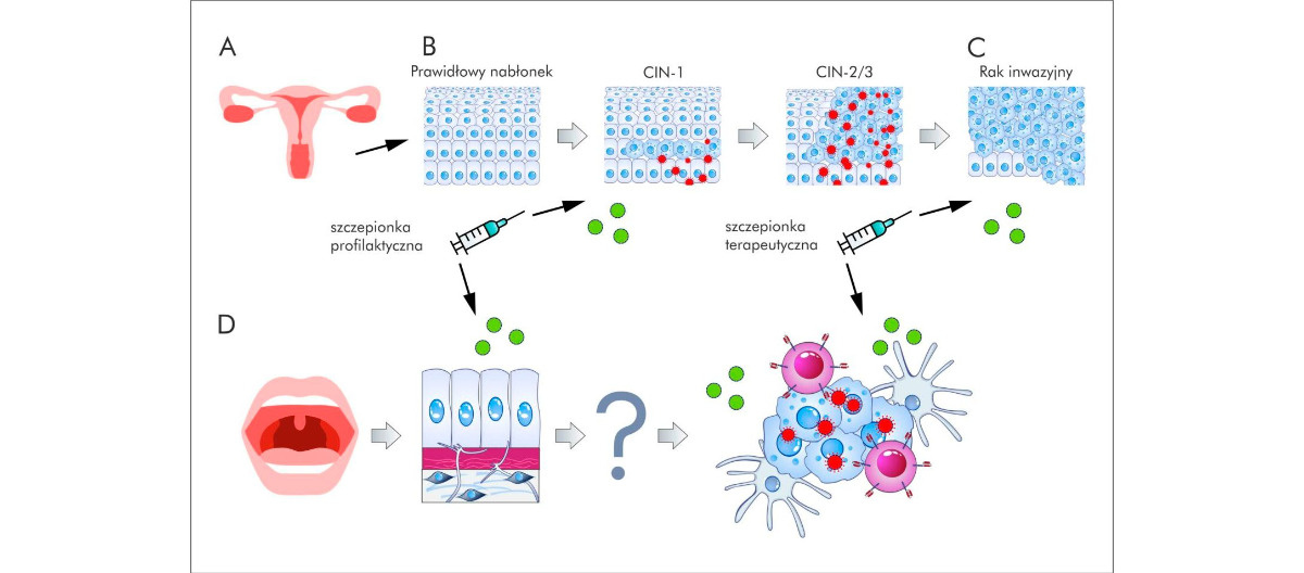 Jak jeszcze można sprawdzić bezpieczeństwo i skuteczność szczepień przeciw rakom HPV-zależnym? część 1