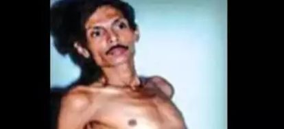 Czy polska klauzula sumienia w takim przypadku też działa ?