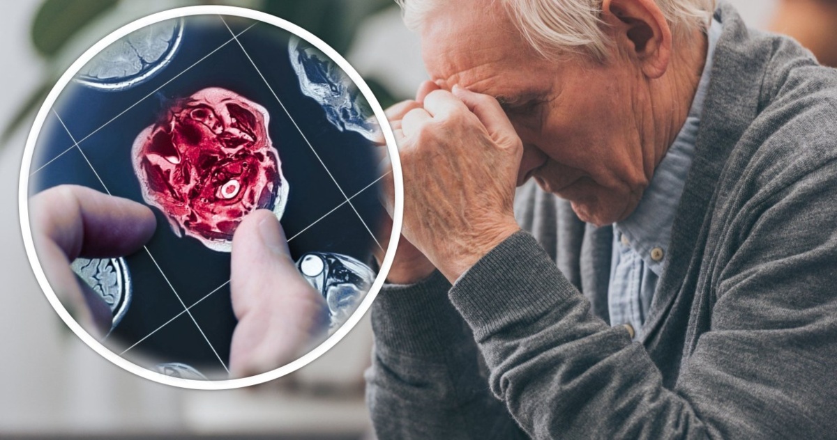 Sensacyjne odkrycie w medycynie. Cofnęli chorobę Alzheimera i przywrócili pamięć (u mysz)