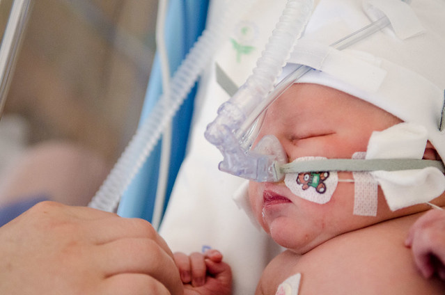 Badacze z UJ i UW pracują nad endoskopem do ratowania życia noworodków