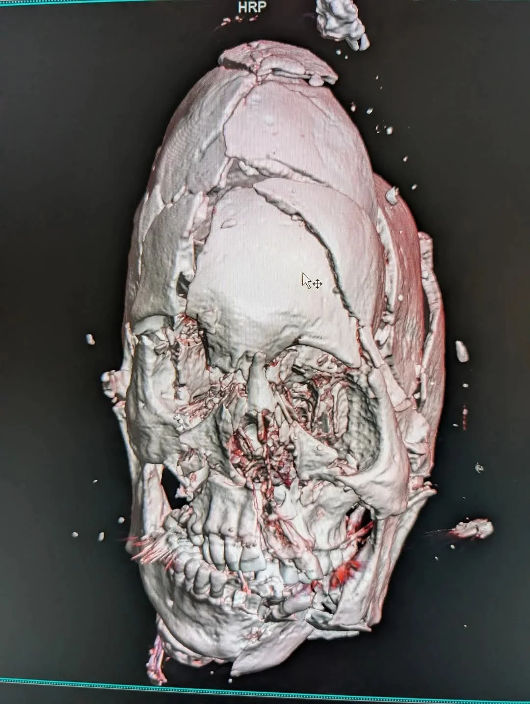 15486566-801a-4e35-aacf-c7b15f9513f7