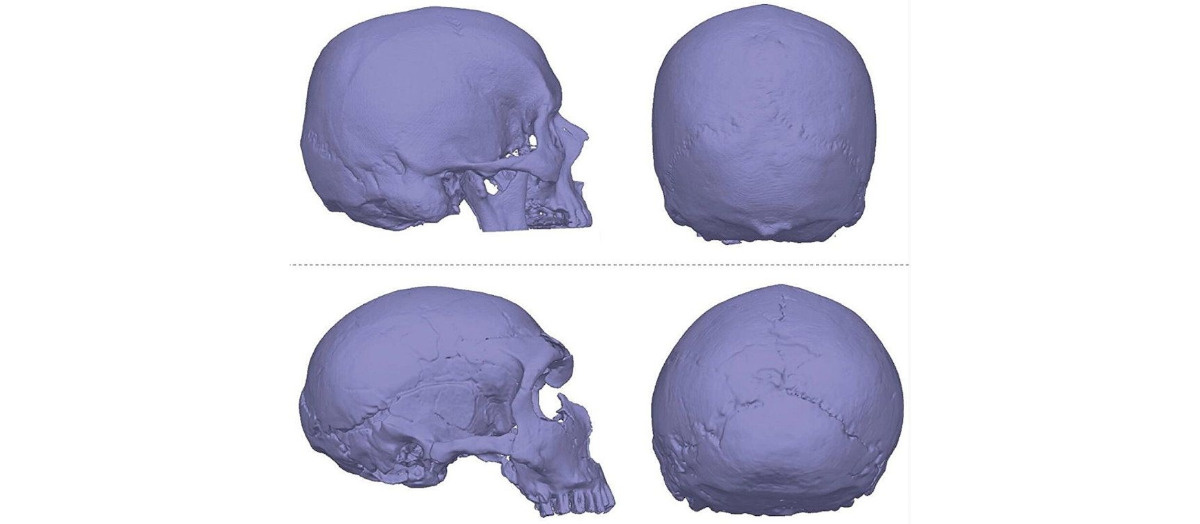 Niektóre wady rozwojowe mózgu otrzymaliśmy w spadku po neandertalczykach