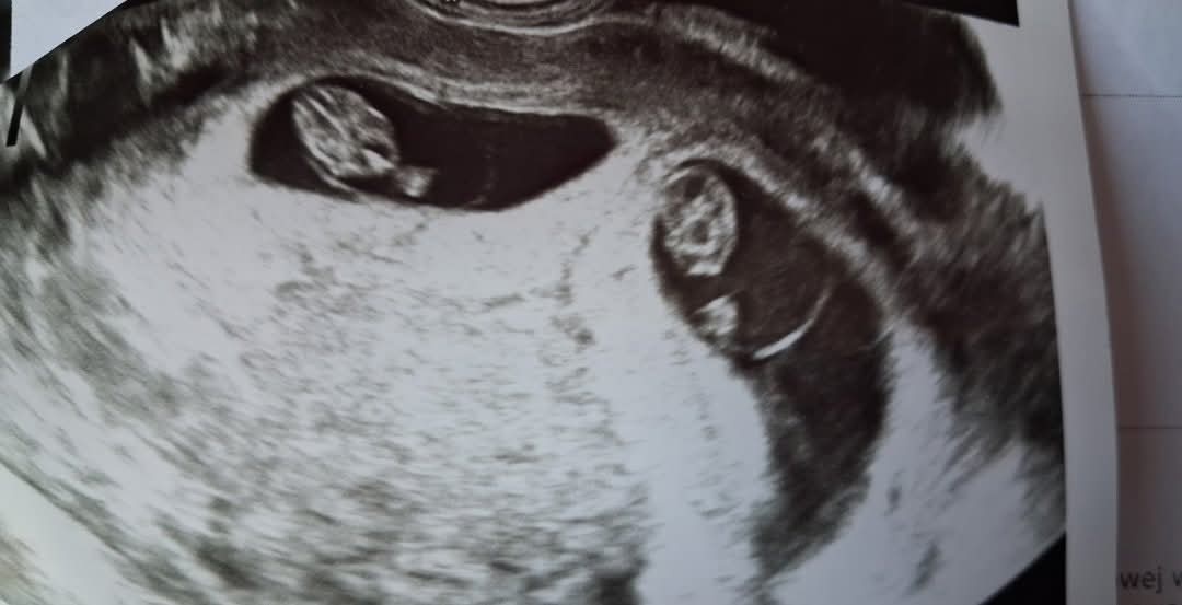 c455ccf7-ceb3-4ff7-980b-ac0c3ba08abe