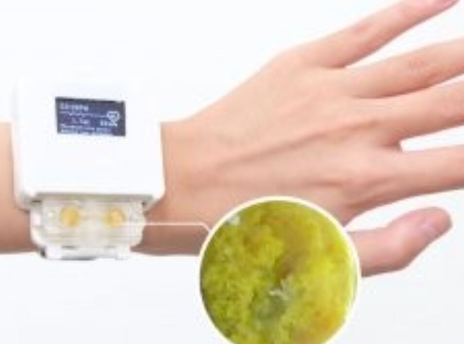 Żywy smartwatch