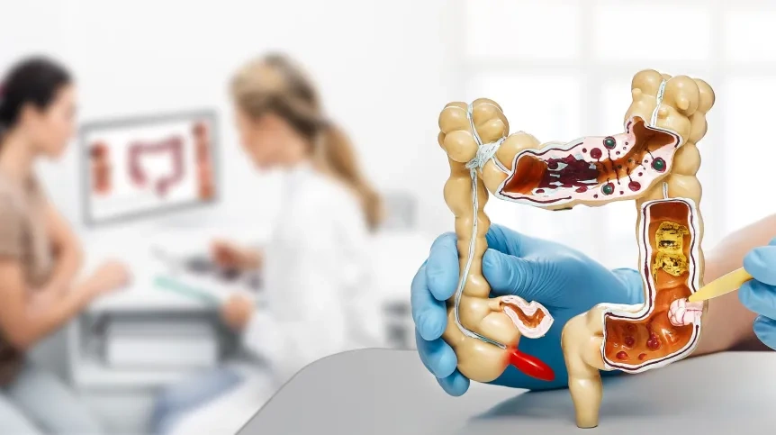 Co czwarty pacjent badany w profilaktyce raka jelita grubego ma zmiany przedrakowe