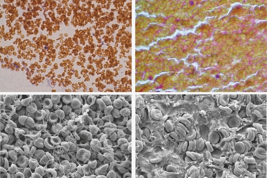 Uczeni z Pennsylwanii odkryli nieznaną funkcję czerwonych krwinek