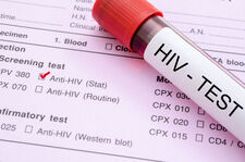 HIV - wirus groźniejszy niż SARS-CoV-2