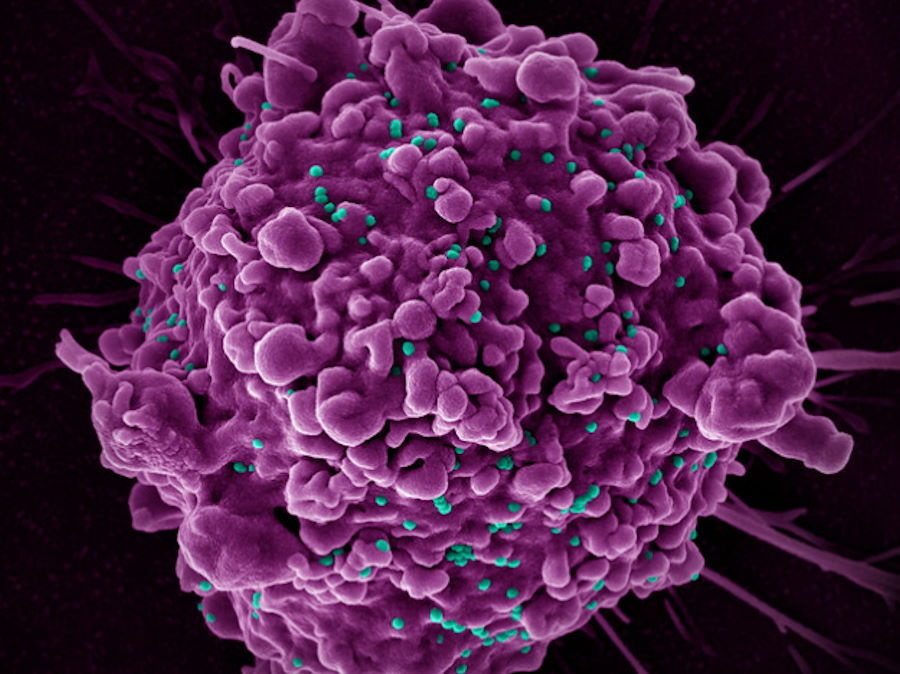 Mutacja zapewniająca odporność na HIV powstała kilka tysięcy lat temu