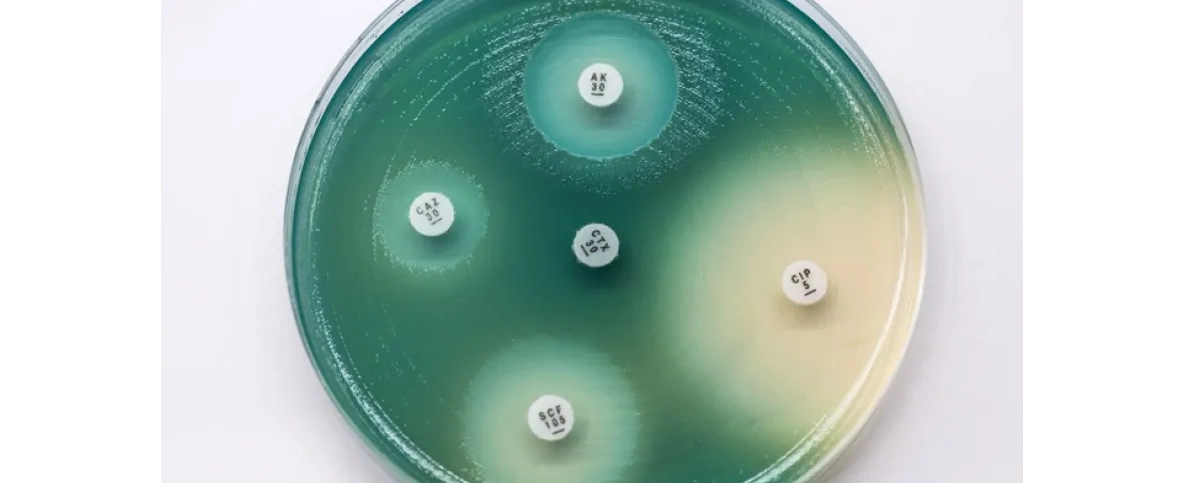 Gdańsk/ Naukowcy opracowali środek na pałeczkę ropy błękitnej