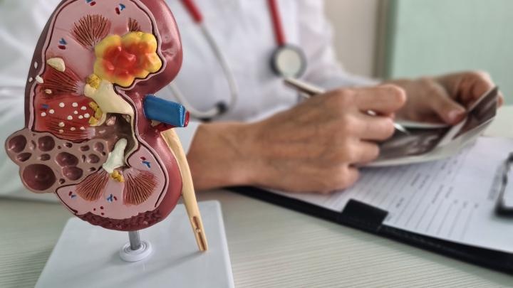 Eksperci alarmują: 4,7 mln Polaków cierpi na przewlekłą chorobę nerek; tylko 5 proc. z nich jest tego świadomych