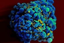 Światowy Dzień AIDS. Dlaczego nie mamy szczepionki przeciwko wirusowi HIV?