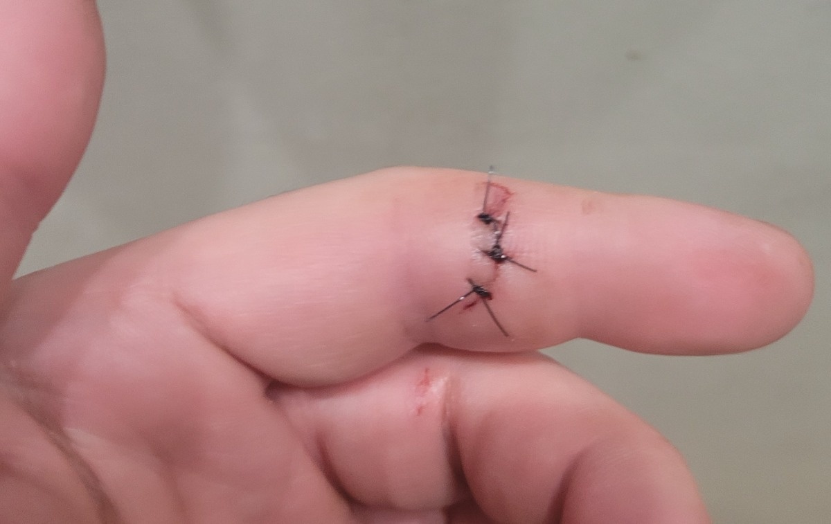 65b55e2a-311c-4908-81a5-711d796dbb70