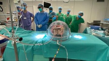 Gdańsk: lekarze przeprowadzili pierwszą perfuzję płuc