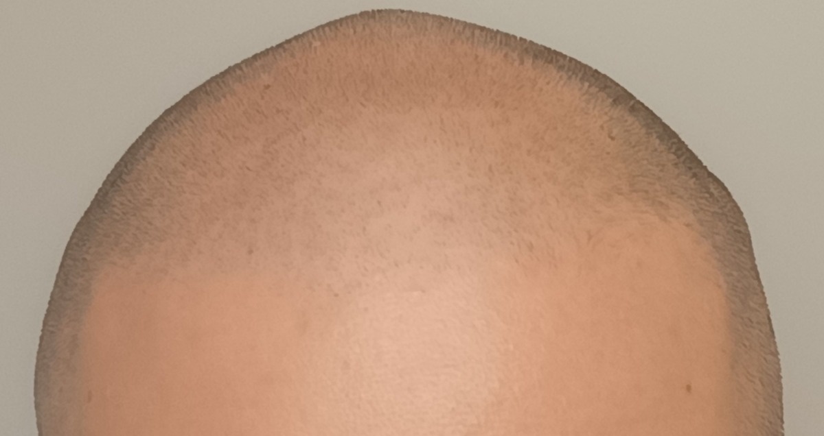 5972d3bd-2fbd-4db0-b5aa-64777215f992