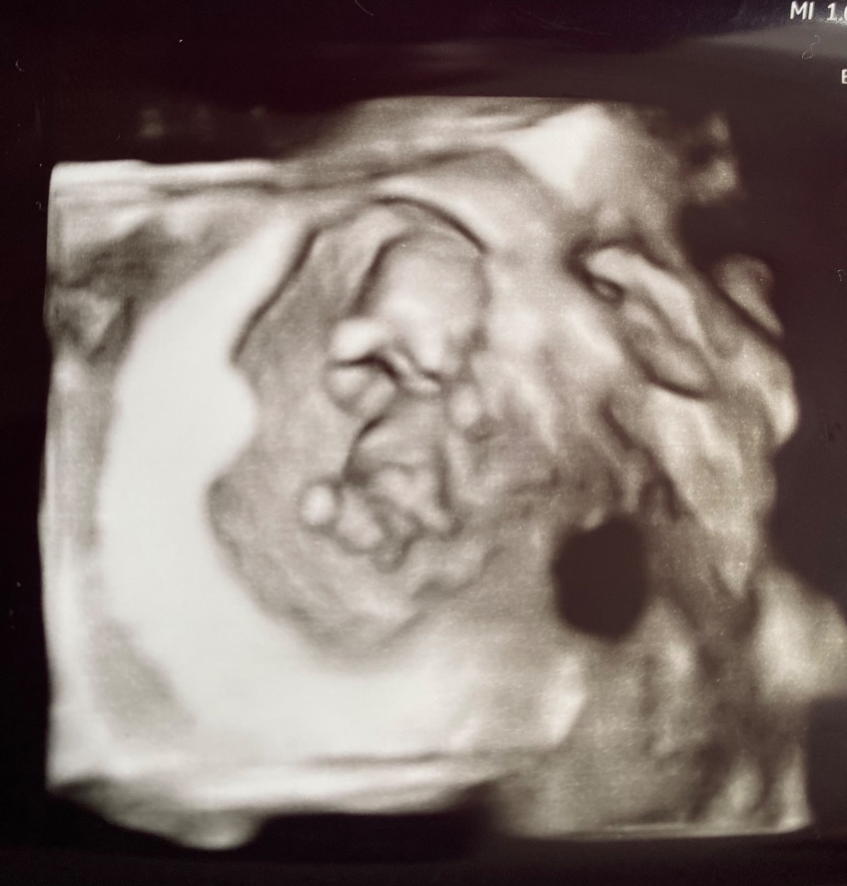 ee1046f5-ca90-4c4b-9bf8-496d6a9885e8