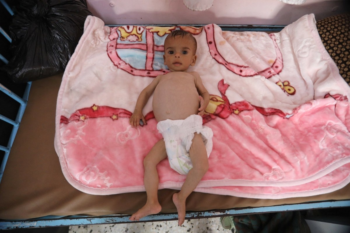 Dzieci konają z głodu w Strefie Gazy. "Pojawił się nowy zabójca"