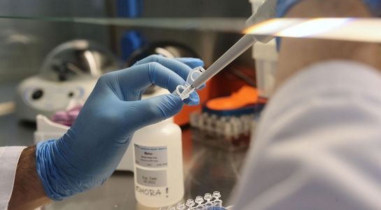 Po raz pierwszy od tygodnia ponad 100 nowych przypadków