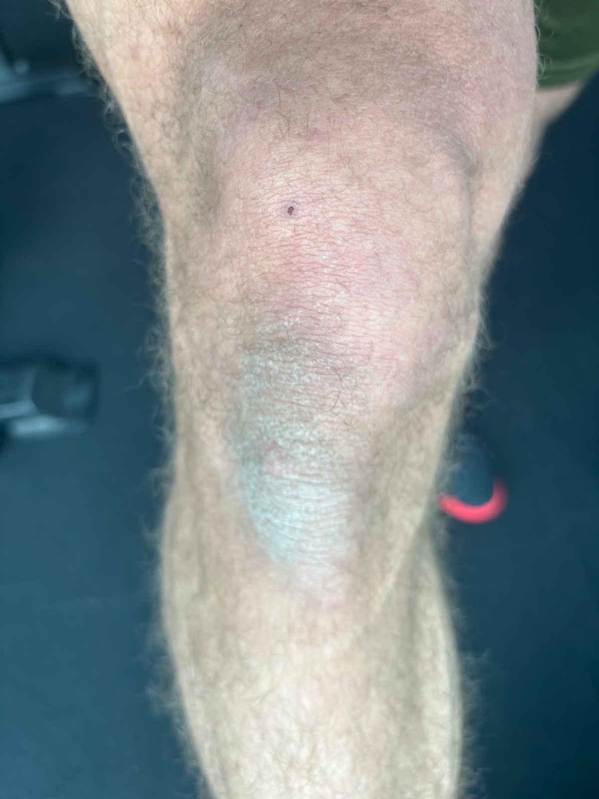 34d458b1-bef9-4756-b4cf-d06e673ce62b