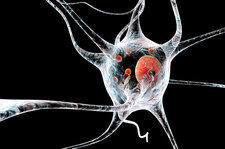 Innowacyjny lek na chorobę Parkinsona