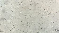 Przegrzewanie jąder uszkadza plemniki poprzez stres oksydacyjny - potwierdzają polskie badania