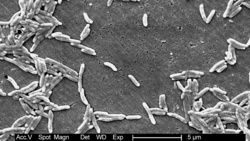 Zatrucie pokarmowe w Turcji: więcej turystów w szpitalu