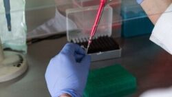 CNN: trzeci na świecie znany przypadek remisji wirusa HIV