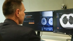 Naukowcy z AGH stworzyli narzędzie wspierające lekarzy radiologów