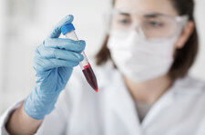 Prosty test krwi wykryje ślady raka płuc