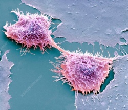 Śmiertelny człowiek, nieśmiertelna komórka