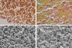 Uczeni z Pennsylwanii odkryli nieznaną funkcję czerwonych krwinek