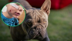 Pies pogryzł twarz 4-letniego Frania. Rodzice szukają właściciela czworonoga