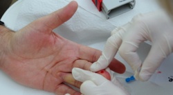 Choroba Alzheimera. Prosty test krwi może pomóc w diagnozie i leczeniu