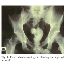 49d561f2-903a-4eb6-97c7-486fe4d7a29e