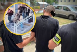 W biały dzień kopnął kobietę w głowę. Szokujący atak w Łodzi