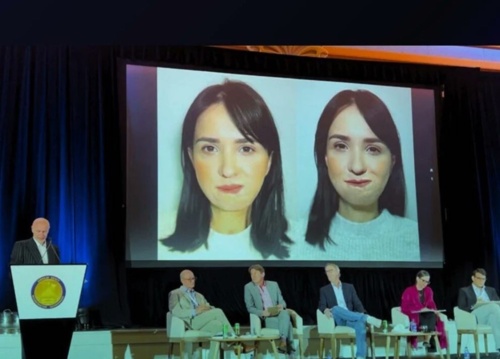 W wyniku rosyjskiego ostrzału 24-letnia Alina Tsoi z obwodu mikołajowskiego straciła część szyi, język, zęby, a - mute - Hejto.pl