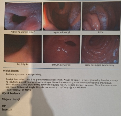 Może ktoś z Was się zastanawia, może sie waha, a może nie ma kogo zapytać. Moja przygoda z "czeskim - jelonek - Hejto.pl