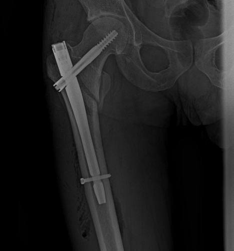 Cześć ﻿#hejto﻿ Zdarzyła mi się dłuższa przerwa w publikacji wpisów spod tagu ﻿#modelarskarzeznia﻿ - Rzeznik - Hejto.pl