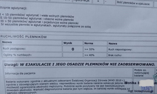 Tak globalnie, to nie jestem wielkim fanem swojego życia, ale kilka rzeczy mi się udało i żałuję, że nie - jelonek - Hejto.pl